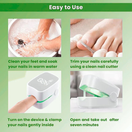 Nail Fungus Laser